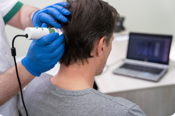 Chequeo capilar: salud del cuero cabelludo, folículo y calidad del cabello